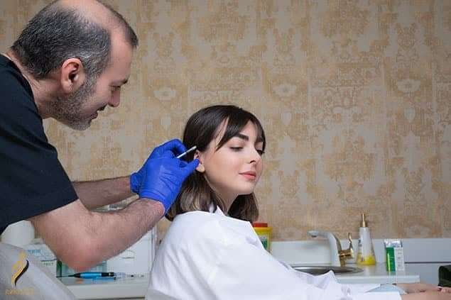 نقاط تزریق بوتاکس میگرن