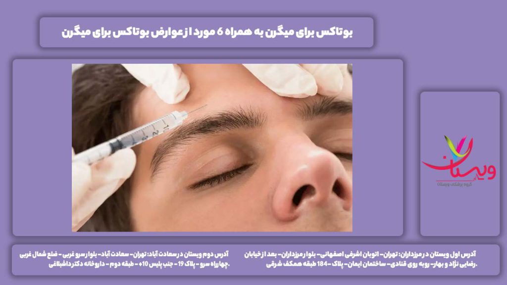 بوتاکس برای میگرن