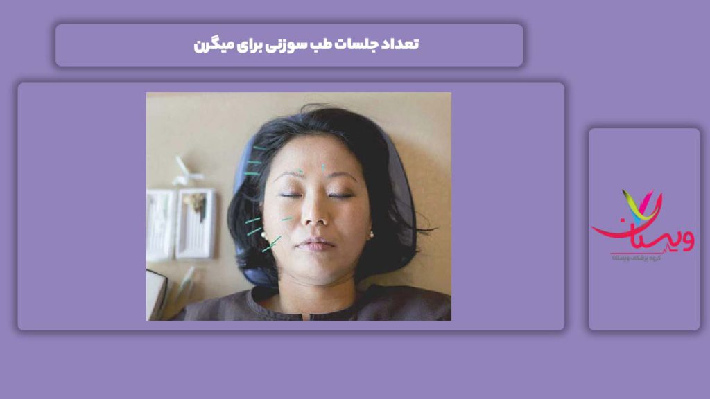 جلسات طب سوزنی برای خوب شدن میگرن تعداد جلسات طب سوزنی برای میگرن