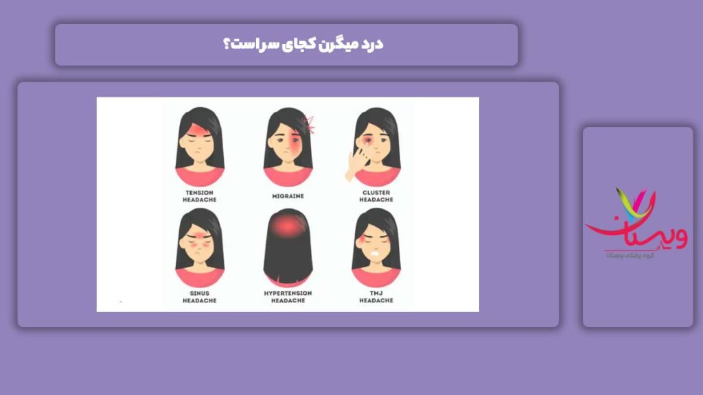 درد میگرن در کجای سر میباشد؟ درد میگرن کجای سر است؟