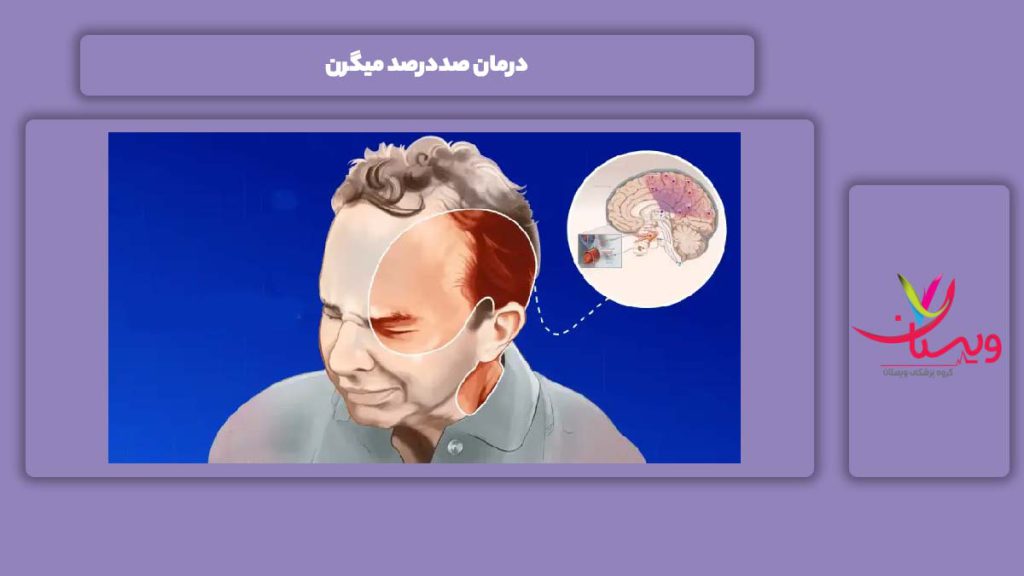 علاج کامل این مریضی درمان صددرصد میگرن