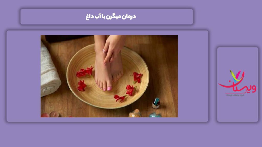 خوب شدن این بیماری با آب داغ درمان میگرن