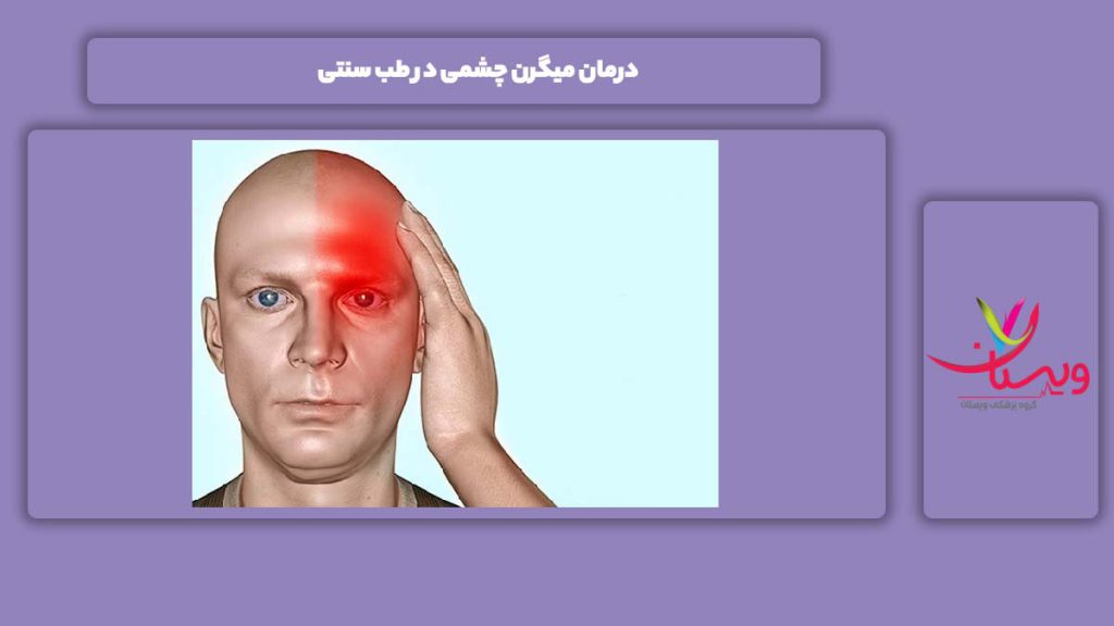 علاج میگرن چشمی با طب سنتی درمان میگرن چشمی در طب سنتی