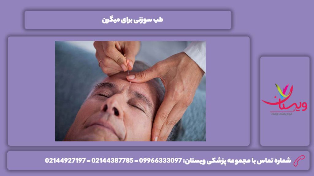 طب سوزنی برای میگرن طب سوزنی برای میگرن