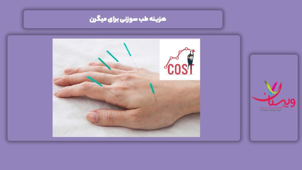 قیمت طب سوزنی برای میگرن هزینه طب سوزنی برای میگرن
