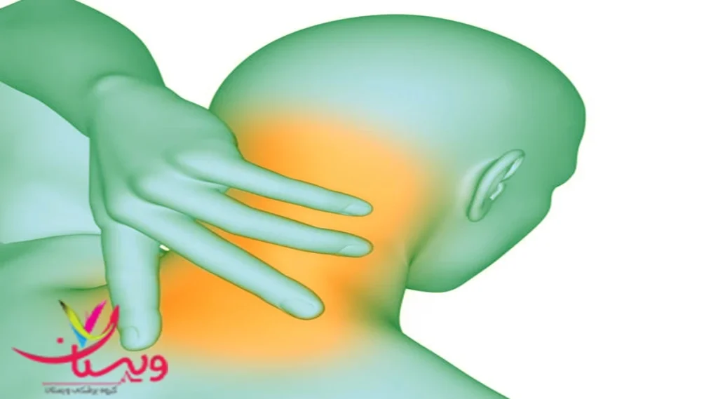 نشانههای بروز میگرن چه چیزی باعث میگرن همی پلژیک می شود؟