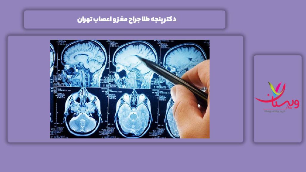 خصوصیات دکترهای پنجه طلا دکتر پنجه طلا جراح مغز و اعصاب تهران