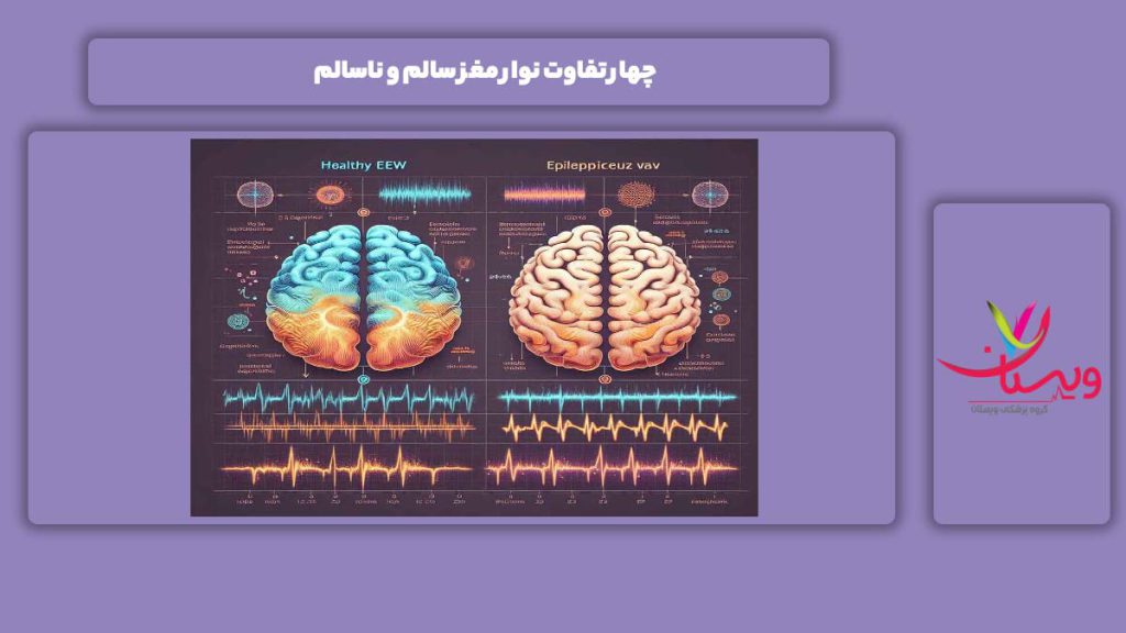 فرقهای بین نوار مغز سالم و ناسالم 4 تفاوت نوار مغز سالم و ناسالم