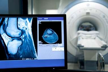 چیستی دیسک کمر دیسک کمر چیست؟