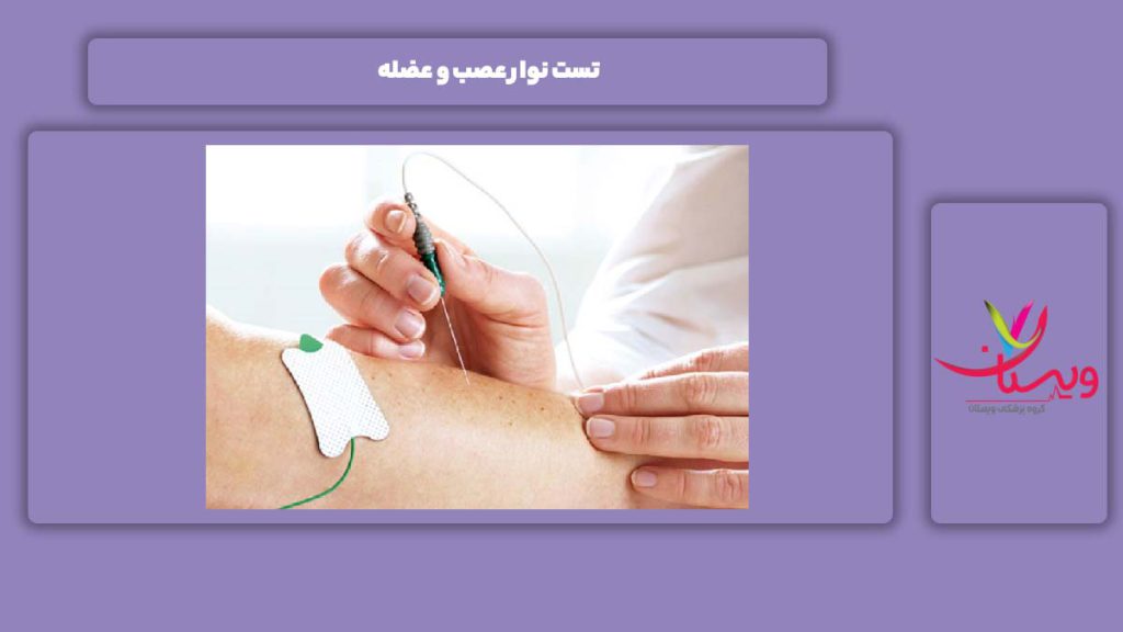 تست نوار عصب و عضله تست نوار عصب و عضله