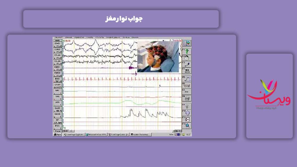 پاسخ این آزمایش جواب نوار مغز