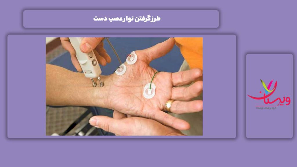 نحوه انجام نوار عصب دست طرز گرفتن نوار عصب دست