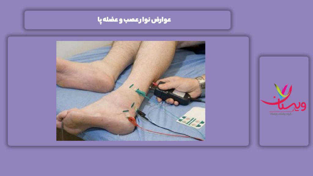معایب انجام این تست 6 عوارض نوار عصب و عضله پا