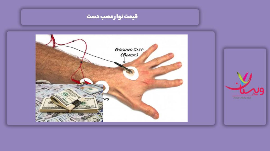 علت مهم و موثر بر قیمت قیمت نوار عصب دست