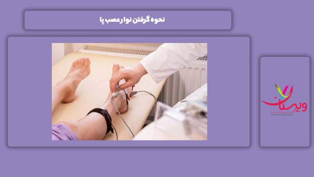 طریقه گرفتن این تست نحوه گرفتن نوار عصب پا