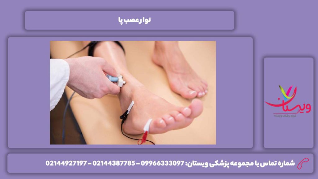 انجام این تست نوار عصب و عضله پا
