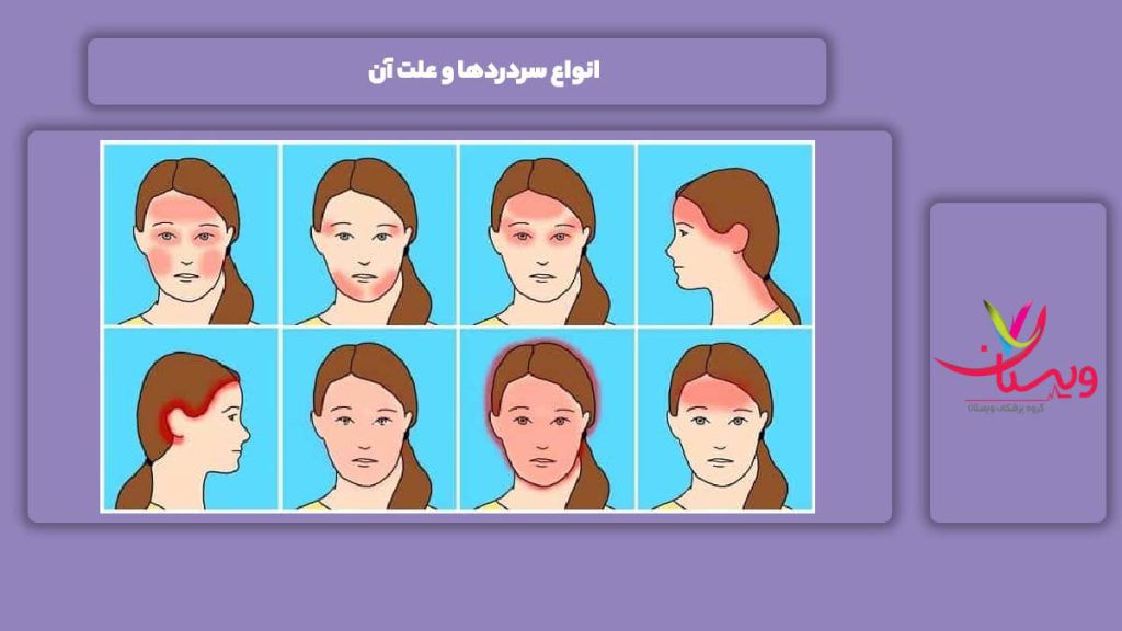 انواع سردرد و علت آن انواع سردردها و علت آن
