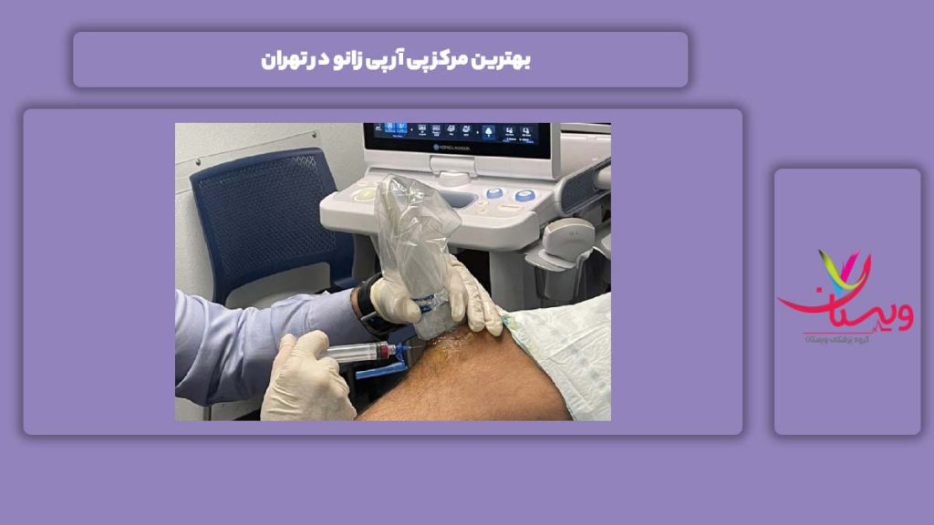 خصوصیات خوبترین مرکز بهترین مرکز پی آر پی زانو در تهران