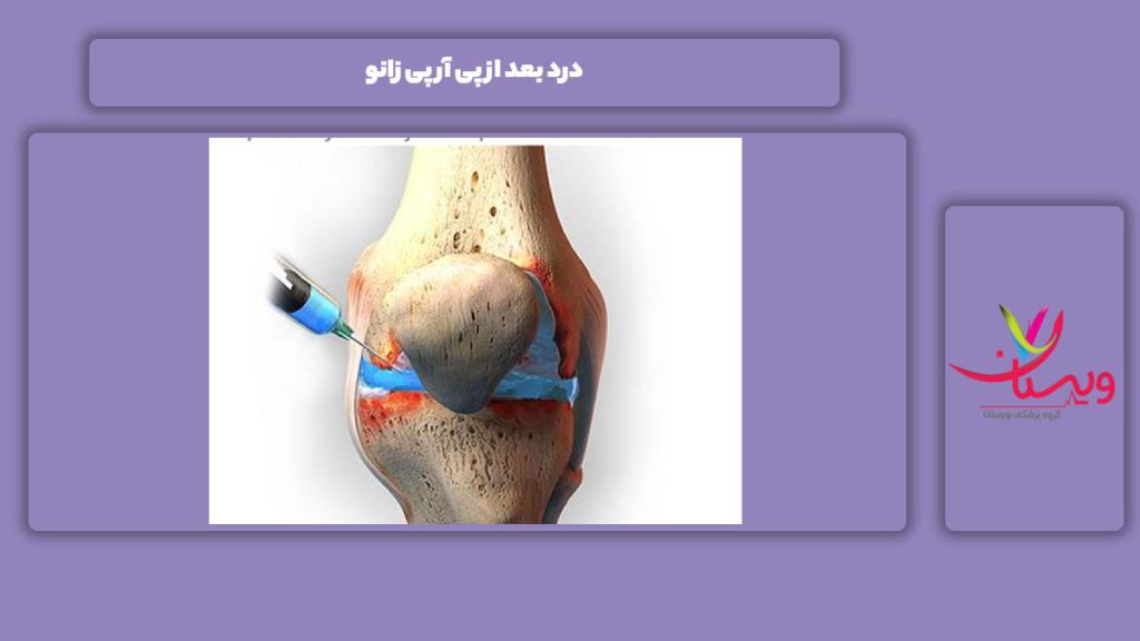 درد بعد از انجام پی آر پی زانو درد بعد از پی آر پی زانو