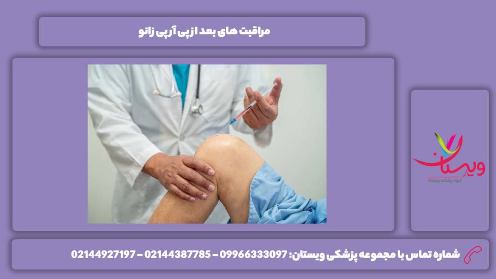 احتیاط بعد از پی آر پی مراقبت های بعد از پی آر پی زانو