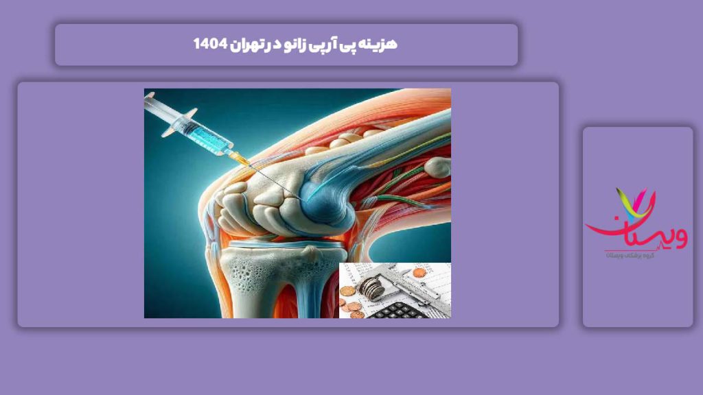 علت پی آر پی زانو تهران در سال 1404 هزینه پی آر پی زانو در تهران 1404