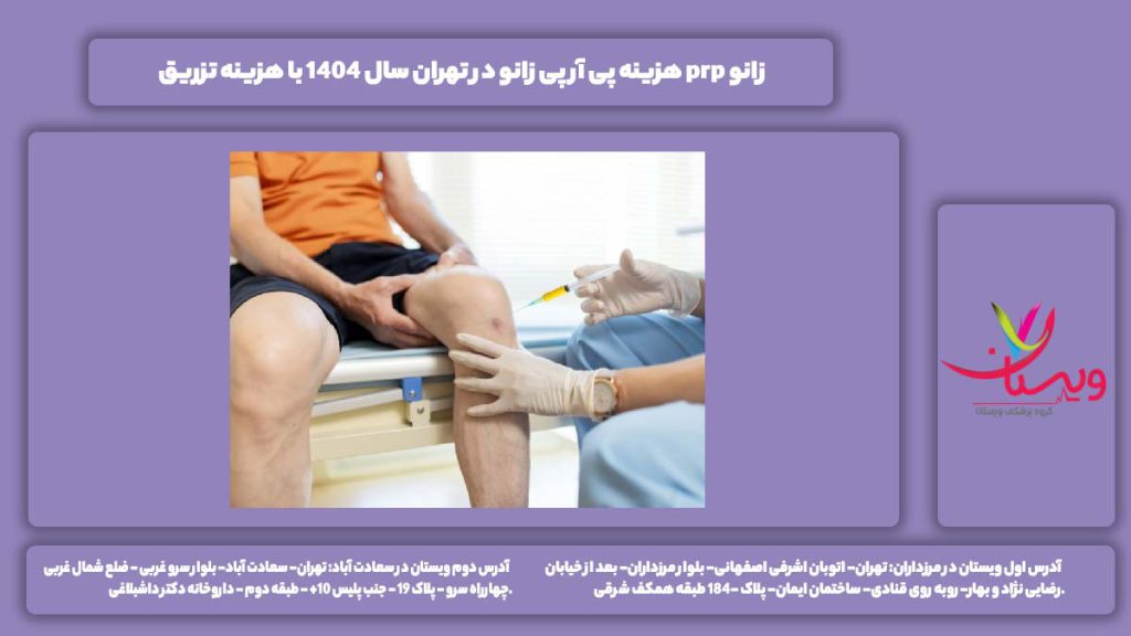 هزینه پی آر پی زانو