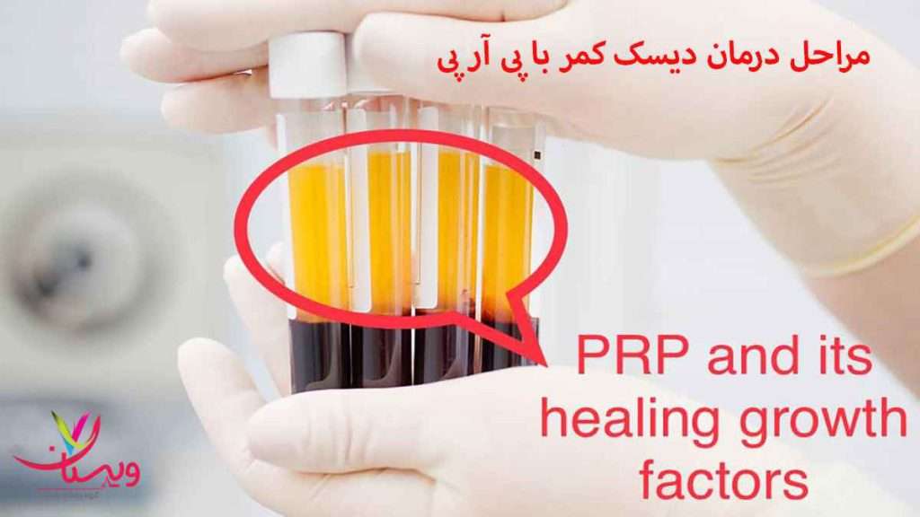 تولید پی ار پی مراحل تولید پی ار پی