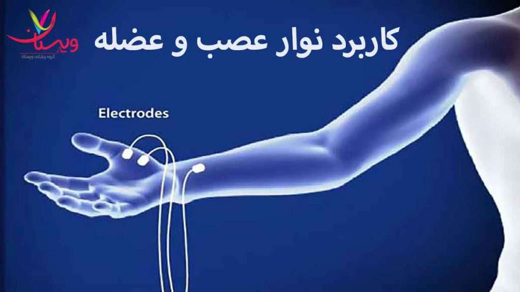 emg ncs کاربرد نوار عصب