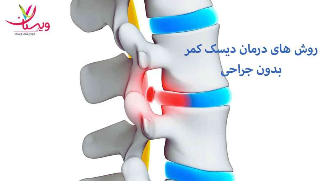 دیسک کمر روش های درمان دیسک کمر