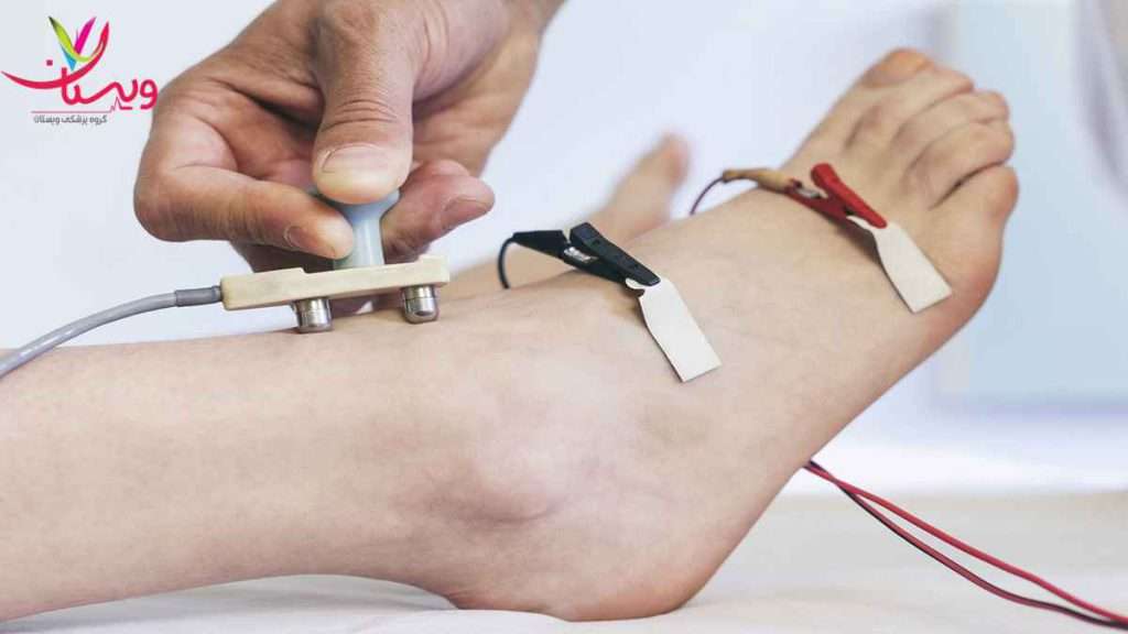 عصب پا آمادگی برای نوار عصب