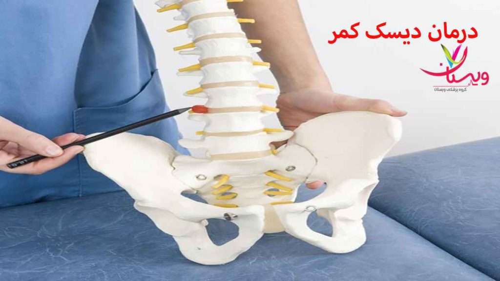 دیسک کمر دیسک کمر