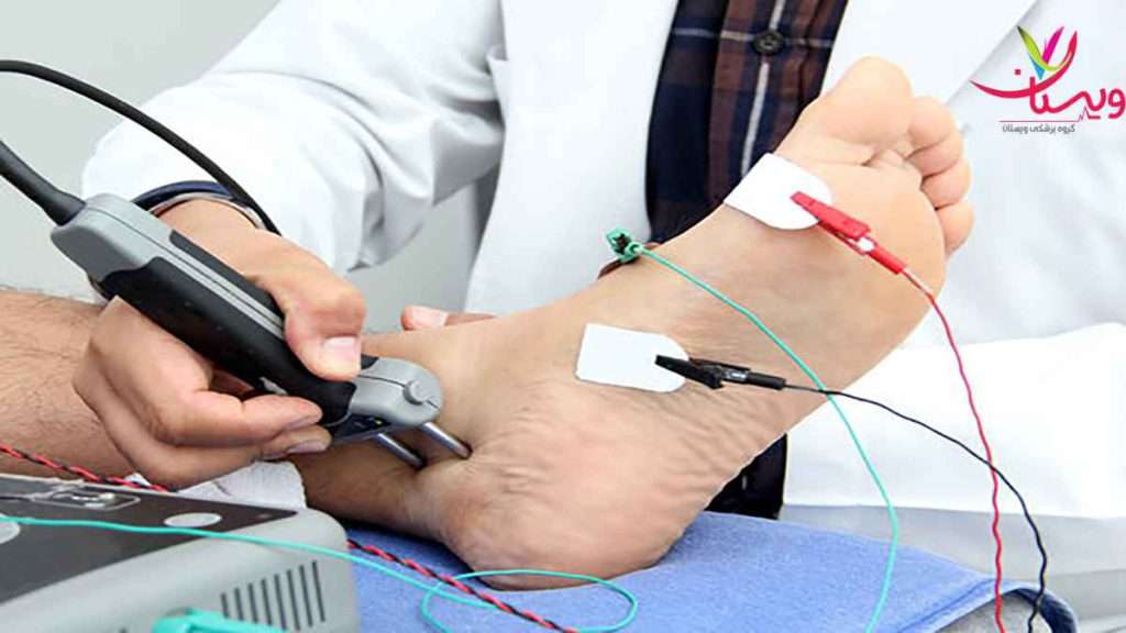 نوار عصب پا عوارض نوار عصب