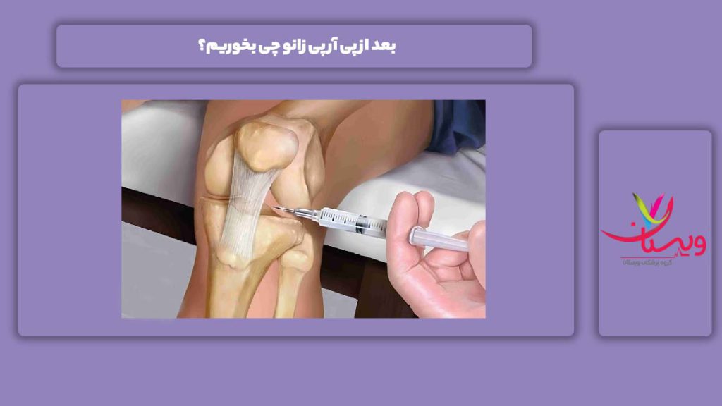 خوردنیهای بعد از انجام پی آر پی بعد از پی آر پی زانو چی بخوریم؟