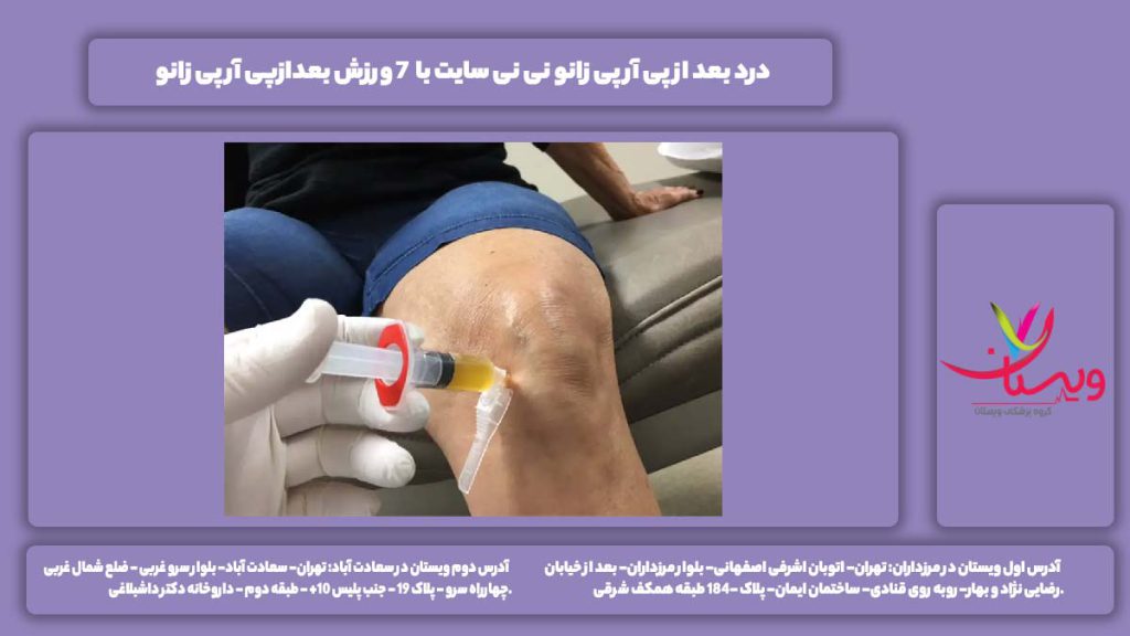 درد بعد از پی آر پی زانو