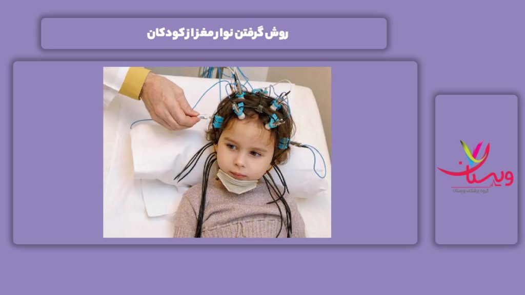 روند گرفتن نوار مغز کودکان روش گرفتن نوار مغز از کودکان