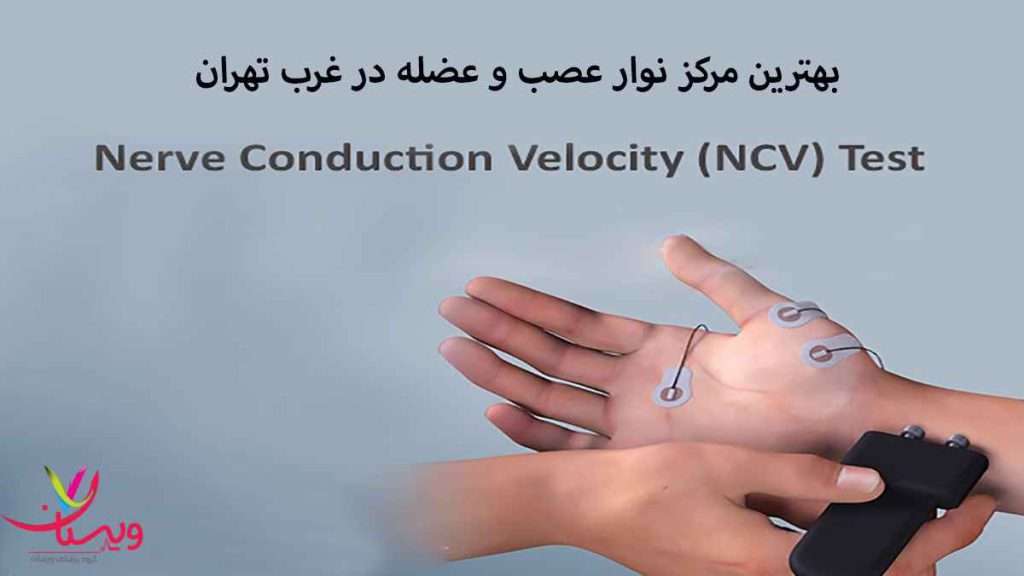 نوار عصب و عضله