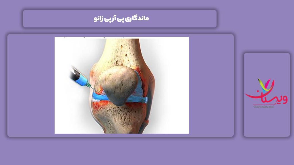 دلایل ماندگاری پی آر پی زانو ماندگاری پی آر پی زانو