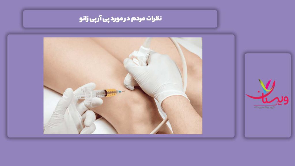 نظرهای مردم نظرات مردم در مورد پی آر پی زانو