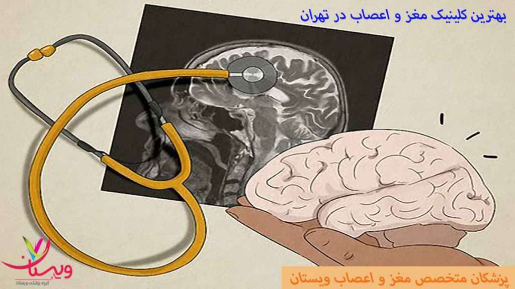 دکتر مغز و اعصاب