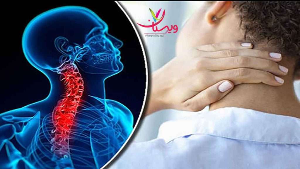 مراقبت بعد از پی آر پی