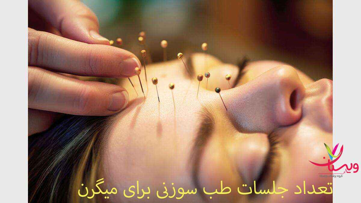 طب سوزنی تعدا جلسات طب سوزنی