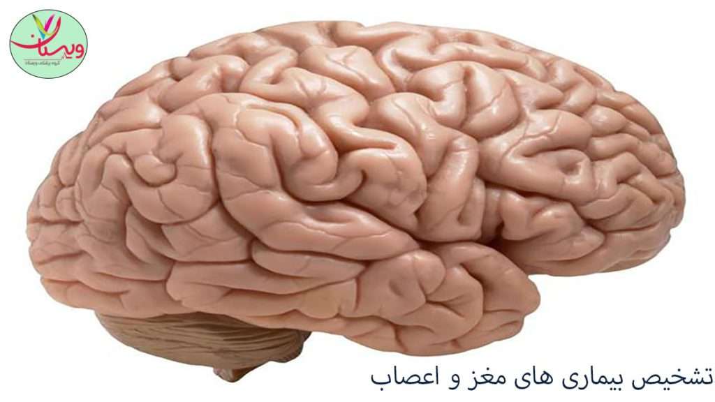 تشخیص بیماری های مغز