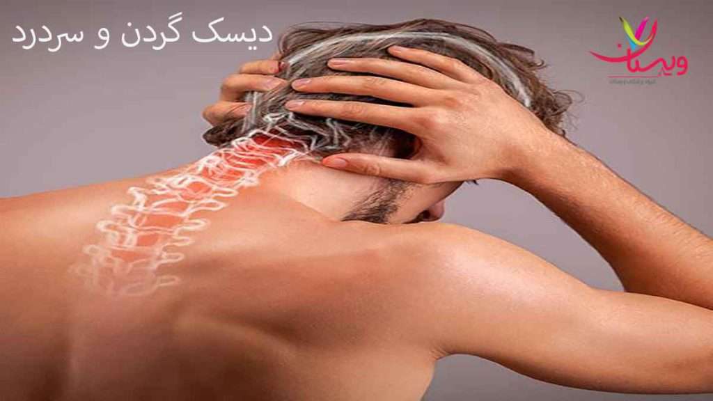 درد دیسک گردن دیسک گردن و سردرد