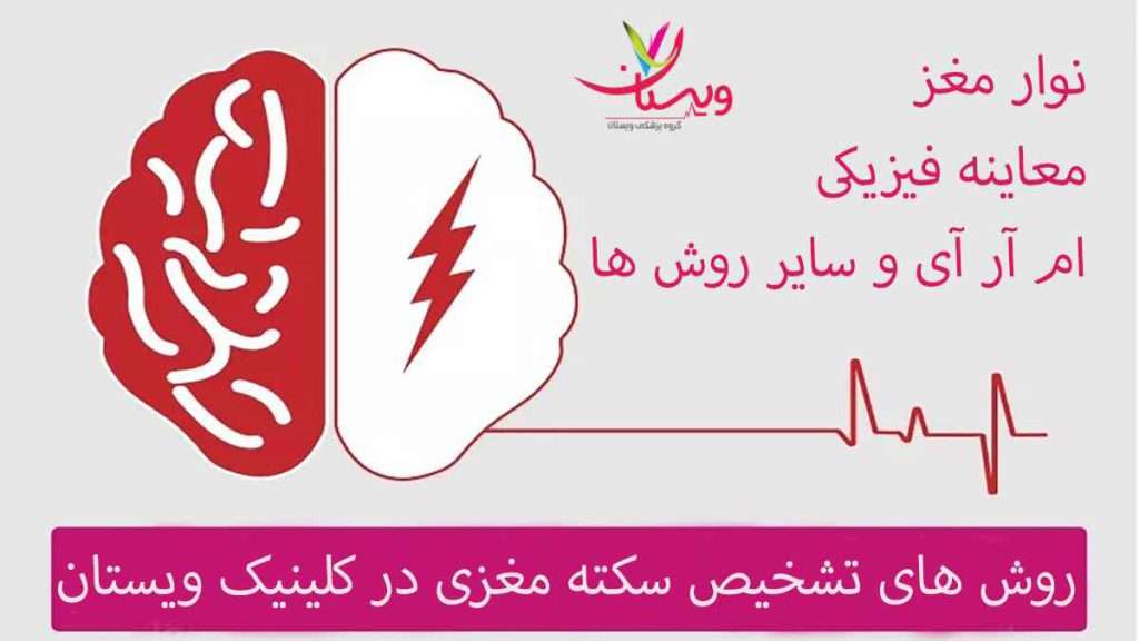 نوار مغز تشخیص سکته مغزی