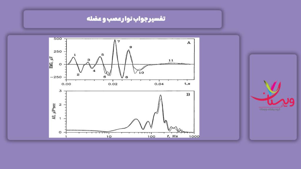جواب نوار عصب و عضله تفسیر جواب نوار عصب و عضله