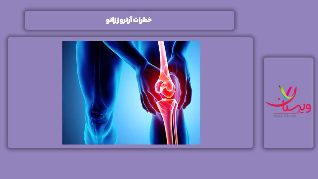 خطرهای آرتروز زانو خطرات آرتروز زانو