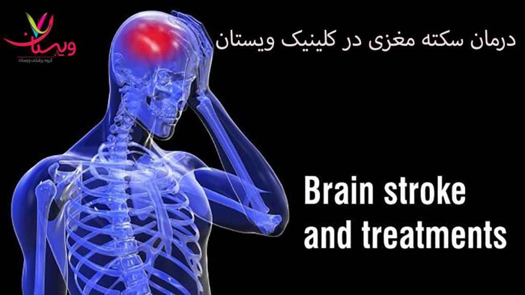 درمان سکته درمان سکته