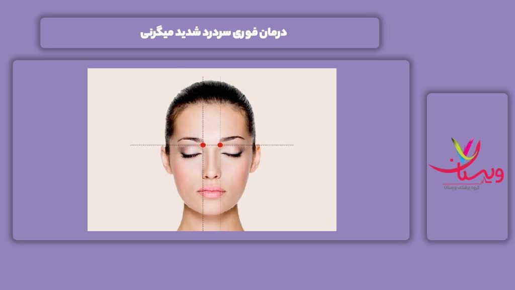 روش سریع برای درمان سردرد شدید میگرنی درمان فوری سردرد شدید میگرنی