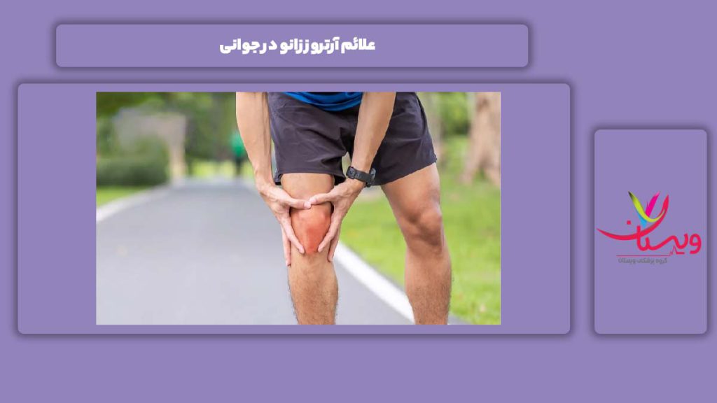 نشانه آرتروز زانو در جوانی علائم آرتروز زانو در جوانی