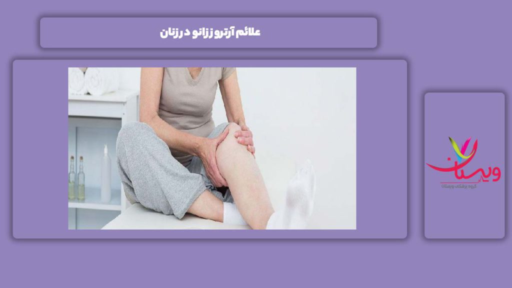 نشانههای آرتروز زنان علائم آرتروز زانو در زنان